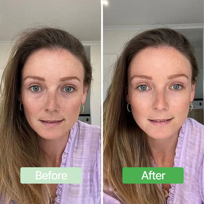 Avocado Eye Mask